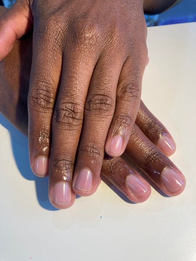 Nail Hygiene